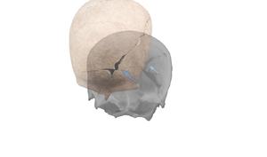 anteprima paleopatologia